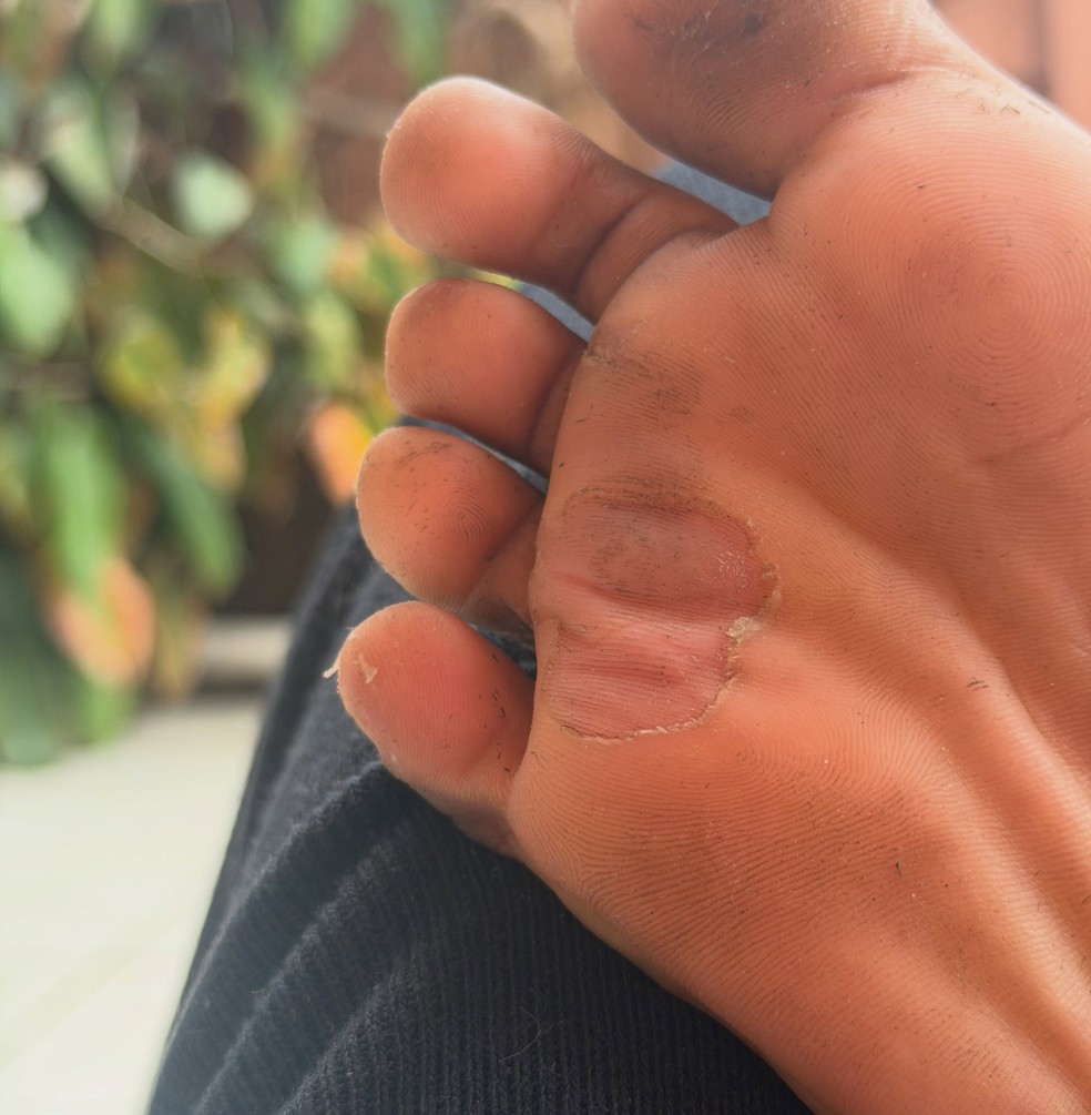 Modelo Dandara Couto mostra marcas pelo corpo após ficar três dias desaparecida — Foto: Reprodução/Instagram