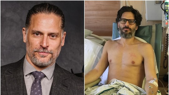 Joe Manganiello publica fotos das sequelas físicas de doença misteriosa; IMAGENS FORTES