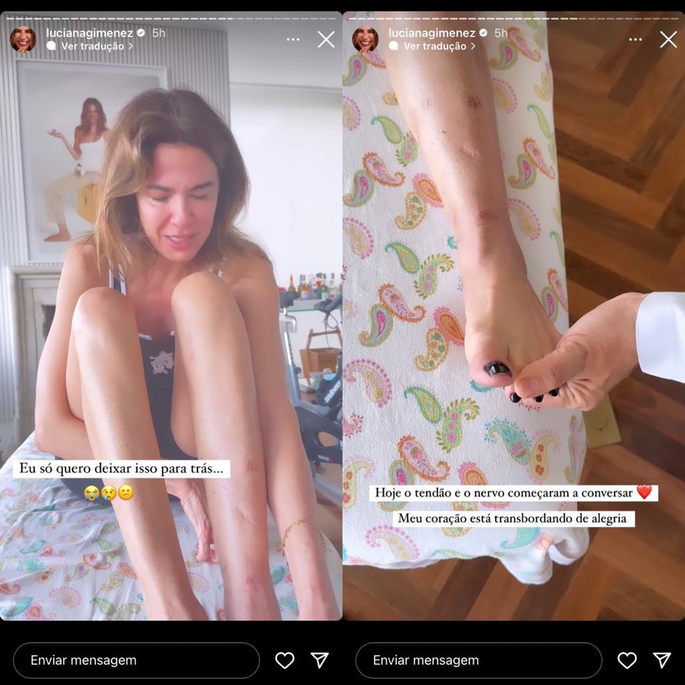 Luciana Gimenez mostra recuperação após acidente — Foto: Reprodução/Instagram
