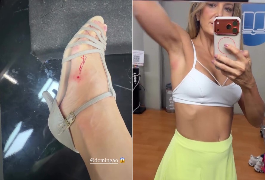 Ticiane Pinheiro mostra bastidores e ferimentos de ensaios do 'Dança dos Famosos'