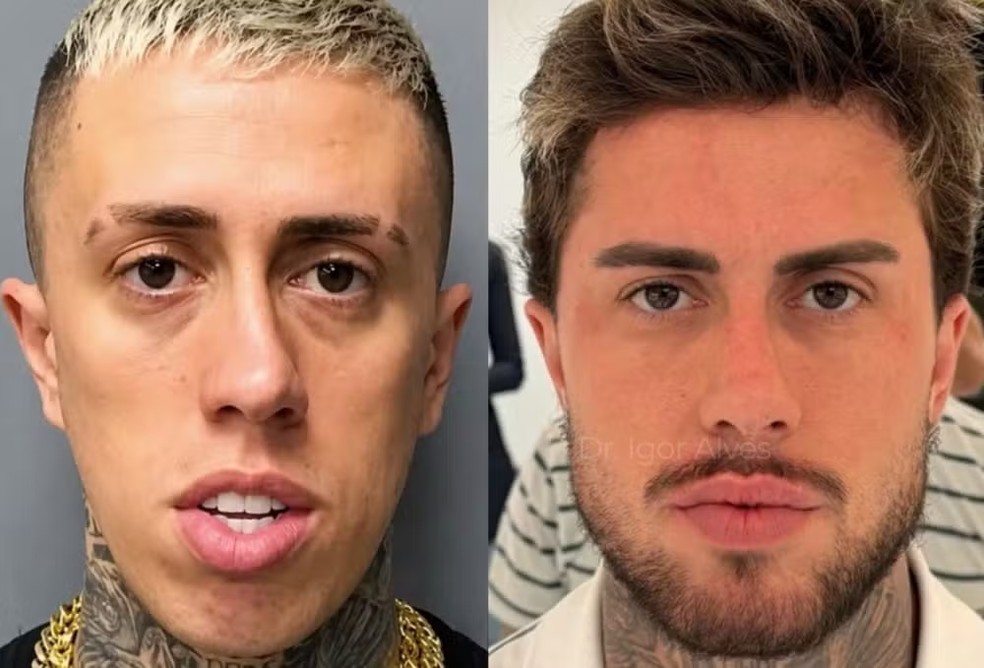 Antes e depois de MC Daniel — Foto: Reprodução/Instagram