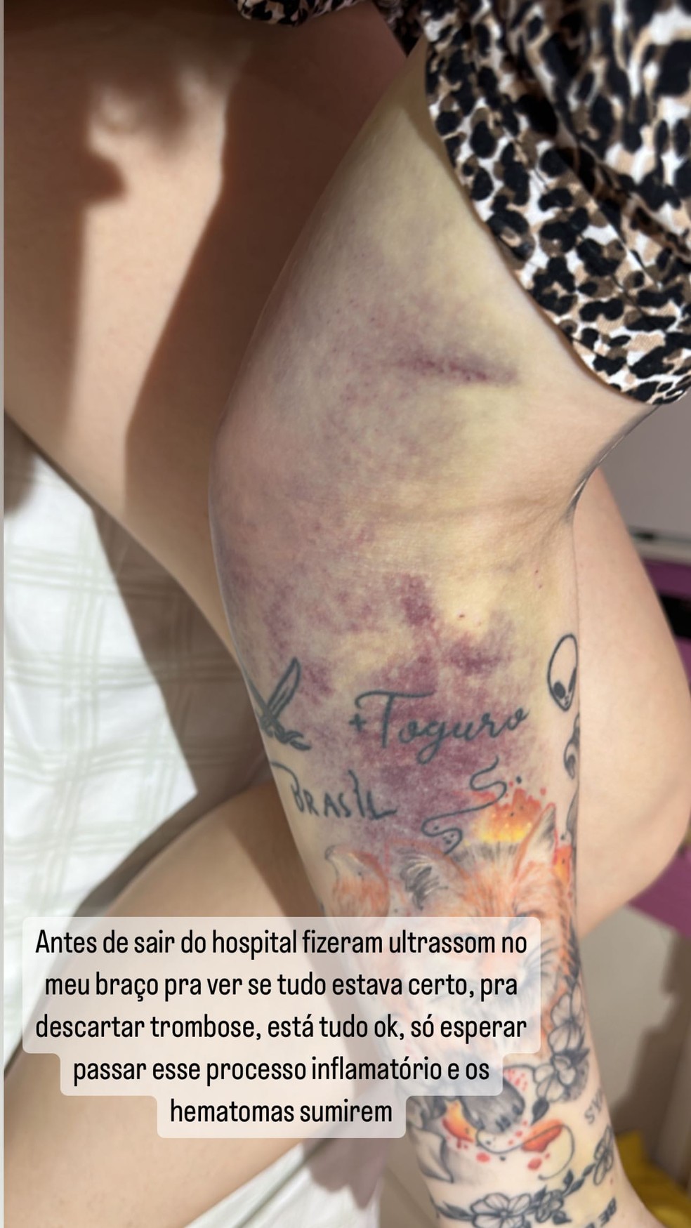Anã do toguro