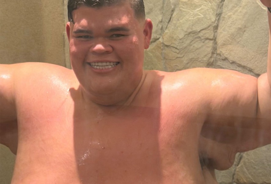 Gordão da XJ atualmente após perder 140 kg