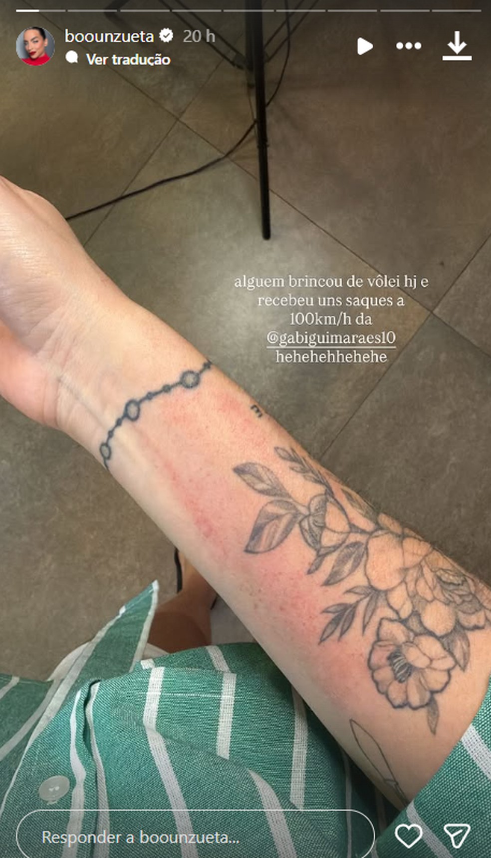 Boo Unzueta mostra hematomas no braço após 'brincar' de vôlei com a ...