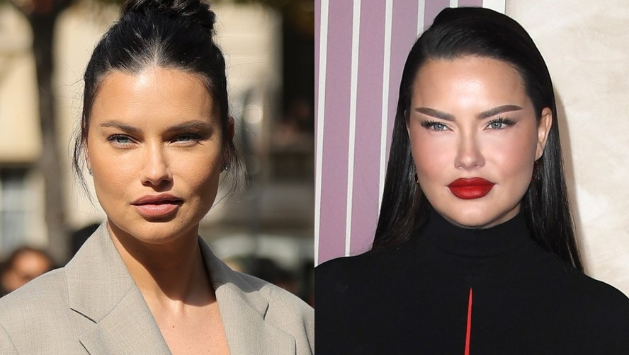 Top Adriana Lima Alvo De Cr ticas Pela Apar ncia M dico Deveria Ser 