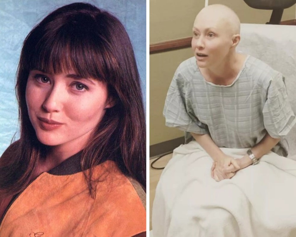 Shannen Doherty passou por cirurgias contra câncer — Foto: Instagram
