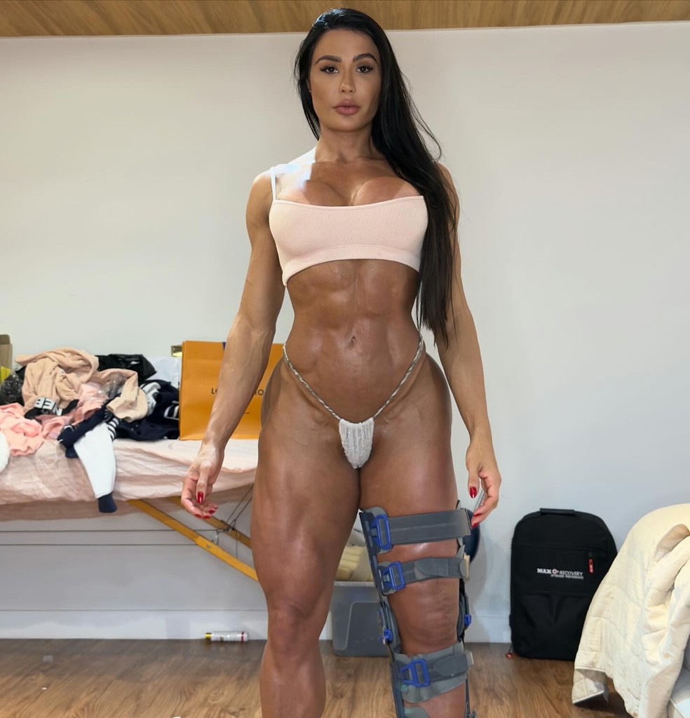 Gracyanne Barbosa fez cirurgia no joelho após lesão no 'Dança dos Famosos' — Foto: Reprodução/Instagram