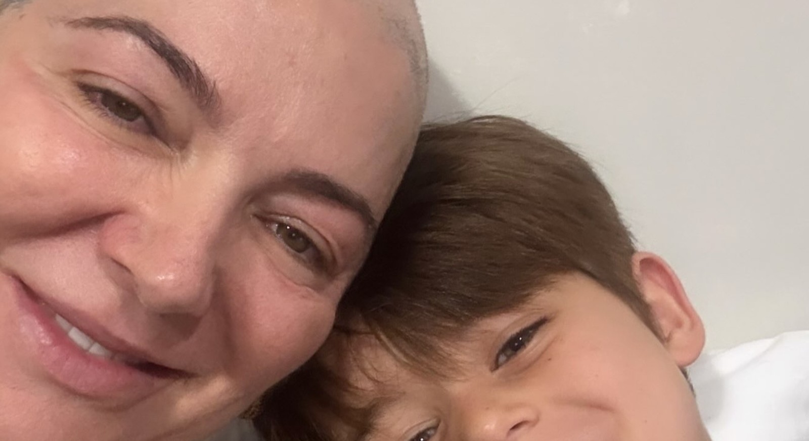 Karina Lucco fala do apoio do neto ao lidar com alopecia: 