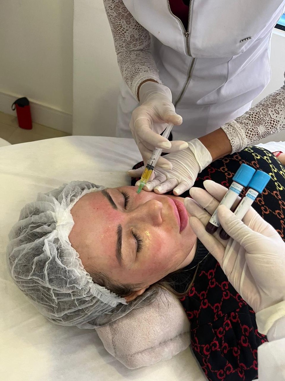 Ju Isen faz reversão de preenchimentos faciais — Foto: Divulgação|CO Assessoria