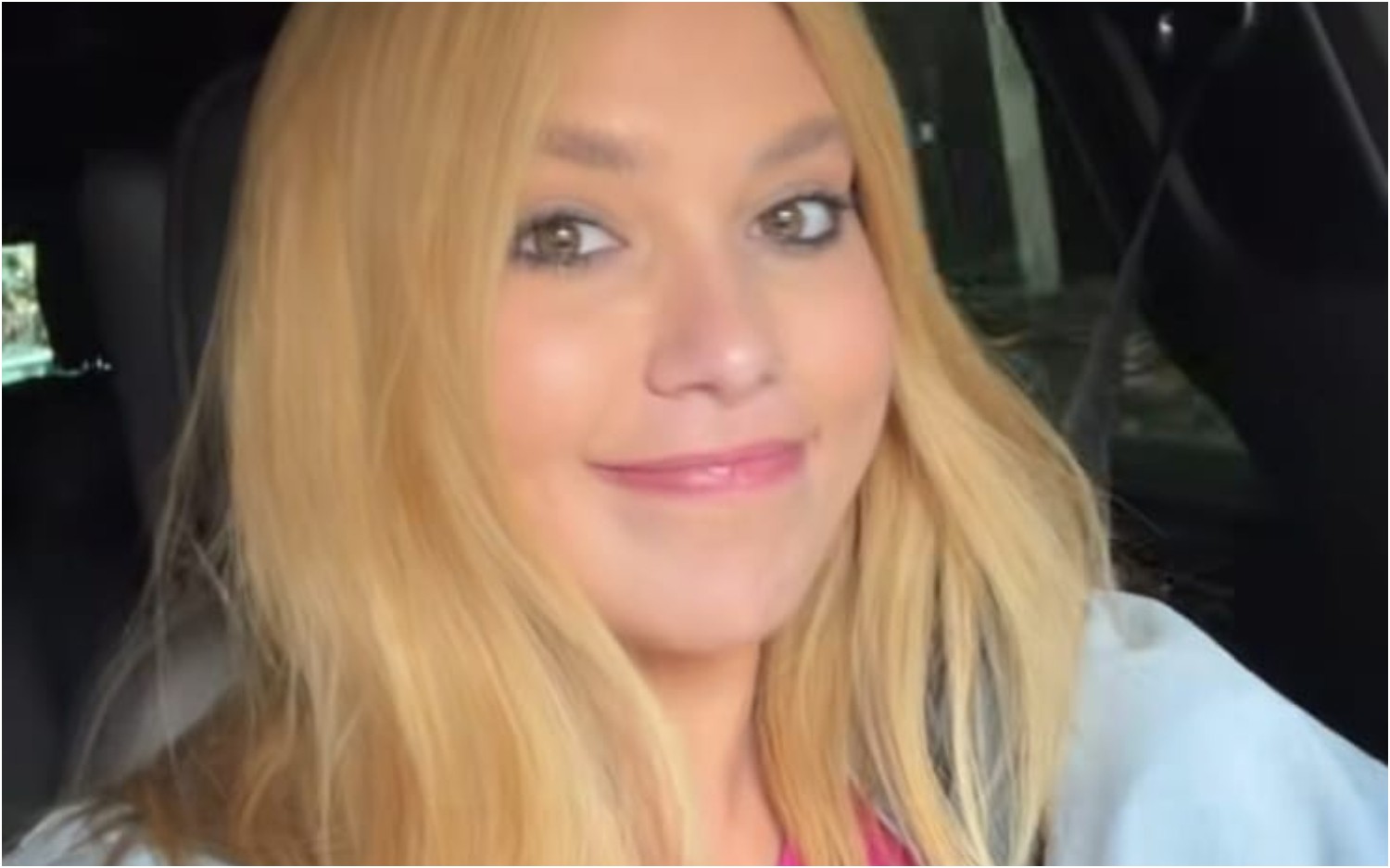 Virginia Fonseca mostra reação alérgica: 'Ansiedade e estresse'