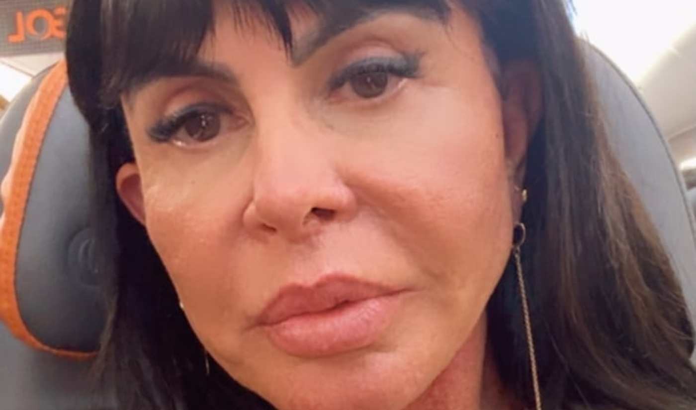 Gretchen raspará cabeça ao vivo para transplante capilar