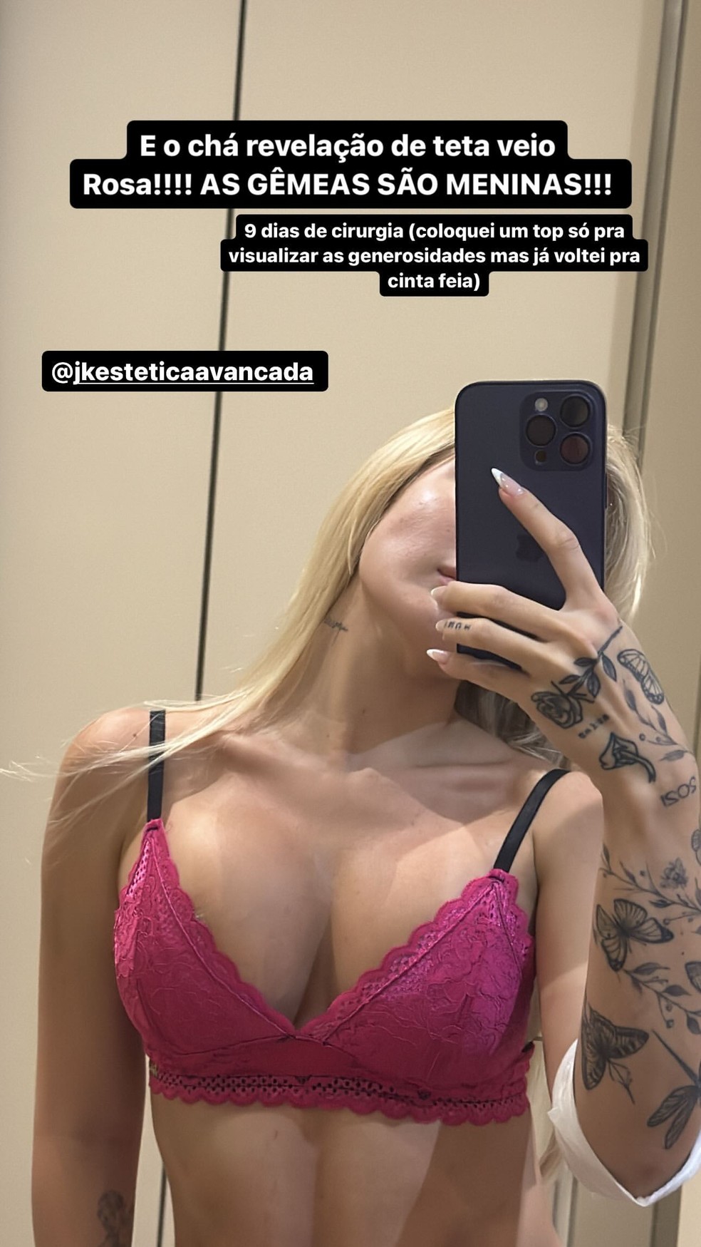 Karoline Lima mostra resultado de mastopexia — Foto: Reprodução/Instagram